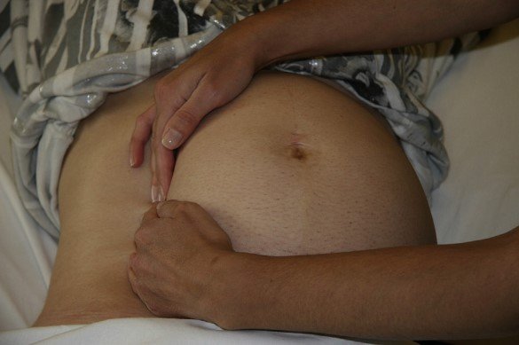 left uterine displacement from left side