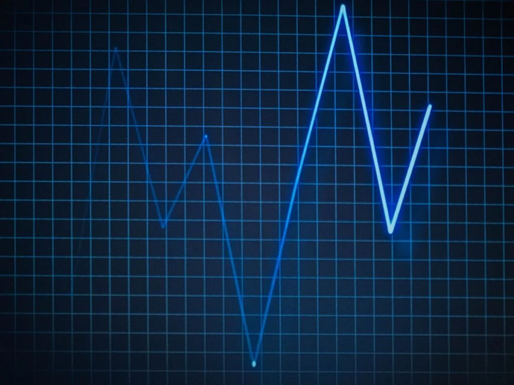 egc bradycardia