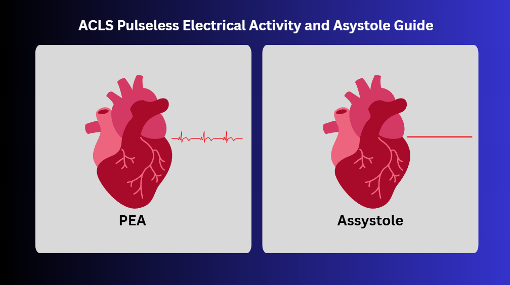 ACLS Pulseless Electrical Activity and Asystole Guide
